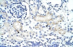 GTF2IRD1 Polyclonal Antibody:Antibodies, Polyclonal