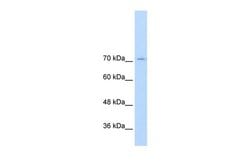 GTF2IRD1 Polyclonal Antibody:Antibodies, Polyclonal