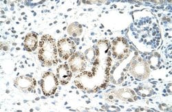 Invitrogen JMJD2D Polyclonal Antibody 100 &mu;L | Buy Online | Invitrogen&trade; | Fisher Scientific