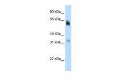 Invitrogen JMJD2D Polyclonal Antibody 100 &mu;L | Buy Online | Invitrogen&trade; | Fisher Scientific
