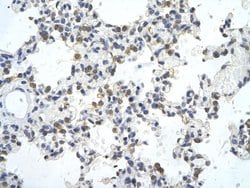 Invitrogen ZNF444 Polyclonal Antibody 100 &mu;L; Unconjugated:Antibodies,