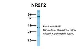Invitrogen NR2F2 Polyclonal Antibody 100 &mu;L; Unconjugated:Antibodies,