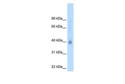 Invitrogen NR2F2 Polyclonal Antibody 100 &mu;L; Unconjugated:Antibodies,