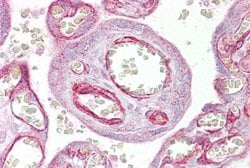 Invitrogen GRHL3 Polyclonal Antibody 100 &mu;L; Unconjugated:Antibodies,