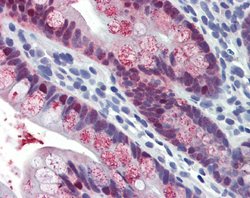 Invitrogen HOXC8 Polyclonal Antibody 100 &mu;L; Unconjugated:Antibodies,