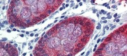 Invitrogen HOXC8 Polyclonal Antibody 100 &mu;L; Unconjugated:Antibodies,