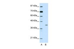 Invitrogen HMBOX1 Polyclonal Antibody 100 &mu;L; Unconjugated:Antibodies,