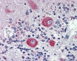 Invitrogen GRHL2 Polyclonal Antibody 100 &mu;L; Unconjugated:Antibodies,