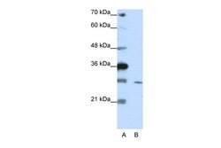 Invitrogen ZNF397 Polyclonal Antibody 100 &mu;L; Unconjugated:Antibodies,
