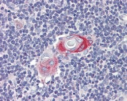 Invitrogen CPXCR1 Polyclonal Antibody 100 &mu;L; Unconjugated:Antibodies,