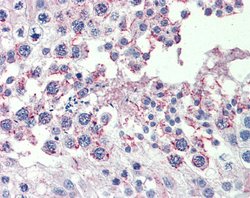 Invitrogen CPXCR1 Polyclonal Antibody 100 &mu;L; Unconjugated:Antibodies,