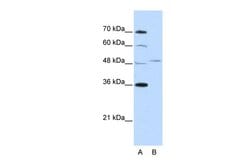 Invitrogen FOXQ1 Polyclonal Antibody 100 &mu;L; Unconjugated:Antibodies,