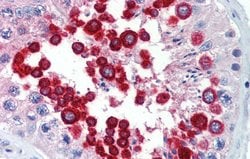 Invitrogen JAZF1 Polyclonal Antibody 100 &mu;L; Unconjugated:Antibodies,