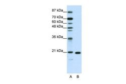 Invitrogen RPL9 Polyclonal Antibody 100 &mu;L; Unconjugated:Antibodies,