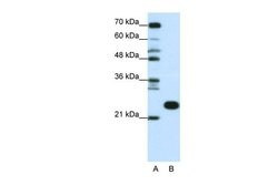 Invitrogen RPL13 Polyclonal Antibody 100 &mu;L; Unconjugated:Antibodies,