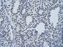 Invitrogen SF3B1 Polyclonal Antibody 100 &mu;L; Unconjugated:Antibodies,