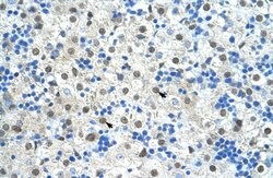 Invitrogen SF3B1 Polyclonal Antibody 100 &mu;L; Unconjugated:Antibodies,