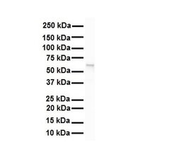 Invitrogen SNRNP70 Polyclonal Antibody 100 &mu;L; Unconjugated:Antibodies,