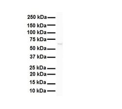 Invitrogen SNRNP70 Polyclonal Antibody 100 &mu;L; Unconjugated:Antibodies,