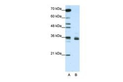 Invitrogen hnRNP A1L2 Polyclonal Antibody 100 &mu;L | Buy Online | Invitrogen&trade; | Fisher Scientific