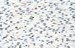 Invitrogen DDX19B Polyclonal Antibody 100 &mu;L; Unconjugated:Antibodies,