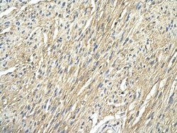 Invitrogen RPS29 Polyclonal Antibody 100 &mu;L; Unconjugated:Antibodies,