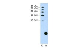 Invitrogen RPS29 Polyclonal Antibody 100 &mu;L; Unconjugated:Antibodies,