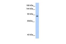 Invitrogen Aconitase 1 Polyclonal Antibody 100 &mu;L; Unconjugated:Antibodies,
