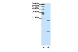 Invitrogen SNRPF Polyclonal Antibody 100 &mu;L; Unconjugated:Antibodies,