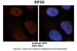 Invitrogen eIF3g Polyclonal Antibody 100 μL; Unconjugated:Antibodies,
