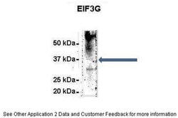 Invitrogen eIF3g Polyclonal Antibody 100 μL; Unconjugated:Antibodies,