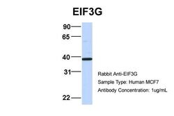Invitrogen eIF3g Polyclonal Antibody 100 μL; Unconjugated:Antibodies,