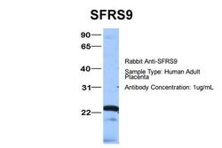 Invitrogen SRSF9 Polyclonal Antibody 100 &mu;L | Buy Online | Invitrogen&trade; | Fisher Scientific