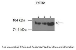 Invitrogen IREB2 Polyclonal Antibody 100 μL; Unconjugated:Antibodies,