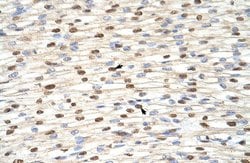 Invitrogen ILF3 Polyclonal Antibody 100 &mu;L; Unconjugated:Antibodies,