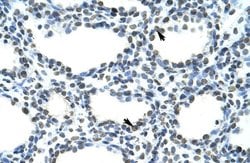 Invitrogen SFRS10 Polyclonal Antibody 100 &mu;L; Unconjugated:Antibodies,
