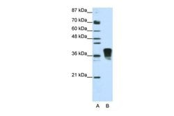 Invitrogen SFRS10 Polyclonal Antibody 100 &mu;L; Unconjugated:Antibodies,