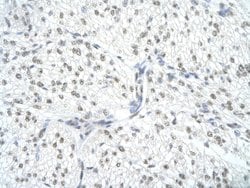 Invitrogen SNRPA Polyclonal Antibody 100 &mu;L | Buy Online | Invitrogen&trade; | Fisher Scientific