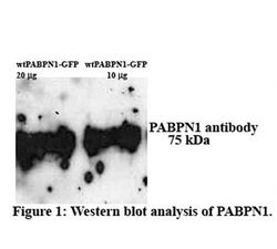 Invitrogen PABPN1 Polyclonal Antibody 100 &mu;L | Buy Online | Invitrogen&trade; | Fisher Scientific
