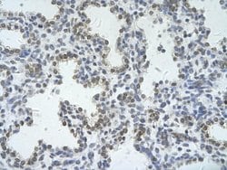 Invitrogen ZRSR2 Polyclonal Antibody 100 μL; Unconjugated:Antibodies,