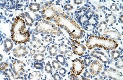 Invitrogen ZRSR2 Polyclonal Antibody 100 μL; Unconjugated:Antibodies,