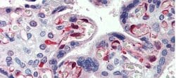 Invitrogen NOP56 Polyclonal Antibody 100 &mu;L; Unconjugated:Antibodies,