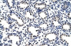 Invitrogen POP4 Polyclonal Antibody 100 &mu;L; Unconjugated:Antibodies,