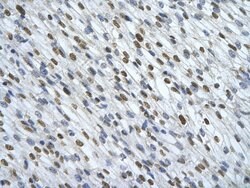 Invitrogen HNRNPA0 Polyclonal Antibody 100 &mu;L | Buy Online | Invitrogen&trade; | Fisher Scientific