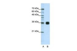 Invitrogen HNRNPA0 Polyclonal Antibody 100 &mu;L | Buy Online | Invitrogen&trade; | Fisher Scientific