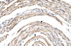 Invitrogen CPSF6 Polyclonal Antibody 100 &mu;L; Unconjugated:Antibodies,