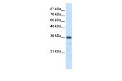 Invitrogen SNRNP35 Polyclonal Antibody 100 &mu;L | Buy Online | Invitrogen&trade; | Fisher Scientific