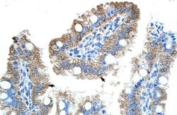 Invitrogen GTPBP9 Polyclonal Antibody 100 μL; Unconjugated:Antibodies,