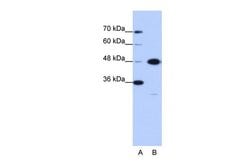 Invitrogen GTPBP9 Polyclonal Antibody 100 μL; Unconjugated:Antibodies,
