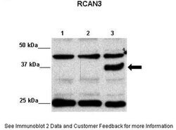 Invitrogen RCAN3 Polyclonal Antibody 100 &mu;L; Unconjugated:Antibodies,